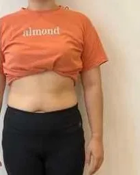 Tư thế và cân đối, trước