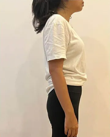 Cải thiện tư thế, sau