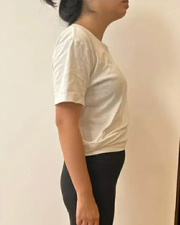 Cải thiện tư thế, trước