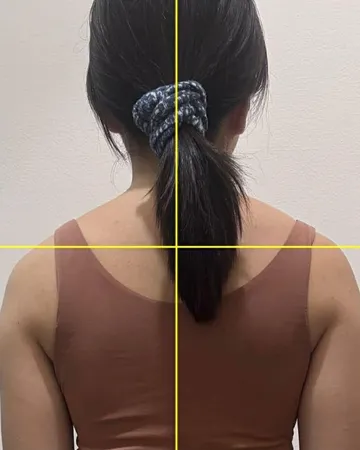 Cân chỉnh trục cơ thể, sau