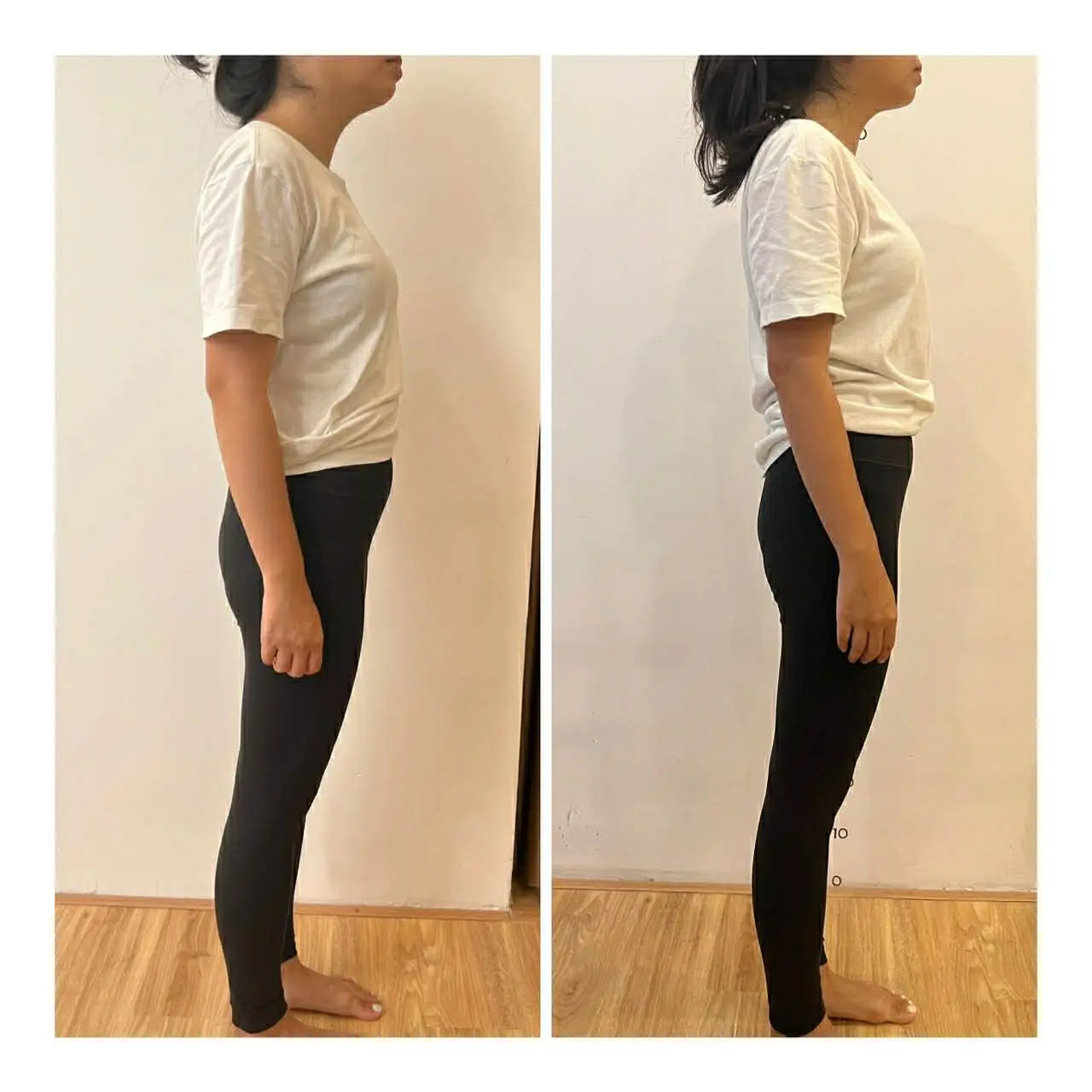 Before posture improvement