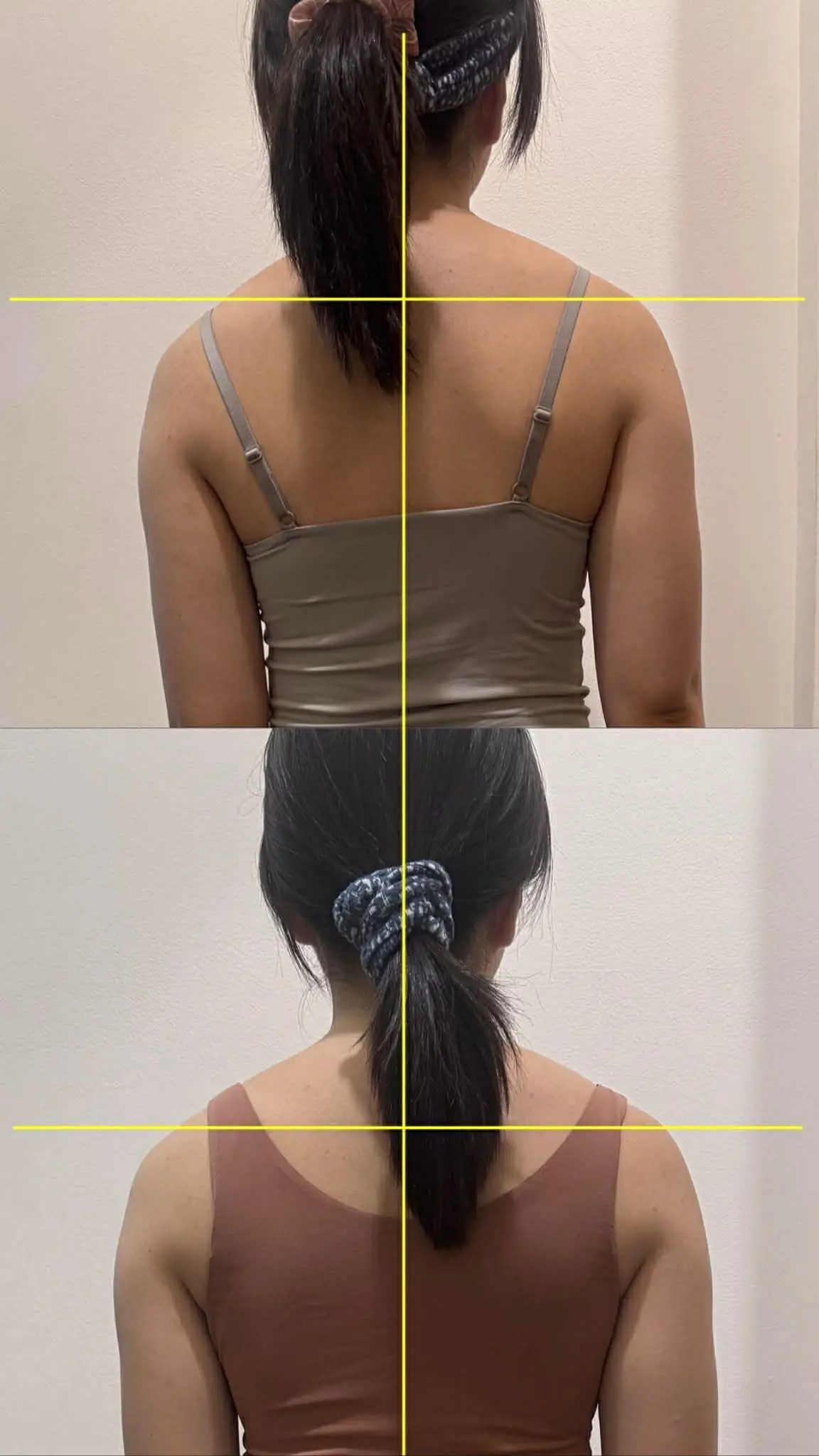 Before alignment correction